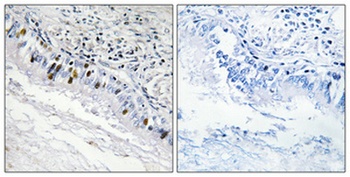 InsP 3-kinase C antibody