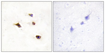 InsP6 Kinase 3 rabbit pAb