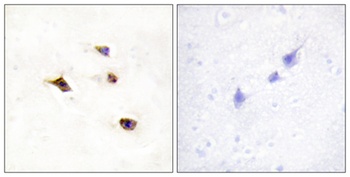 InsP6 Kinase 3 antibody