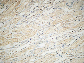 Integrin alphaV antibody