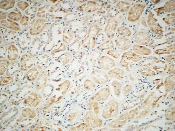 Integrin αV rabbit pAb