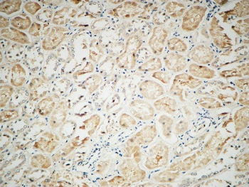 Integrin alphaV antibody