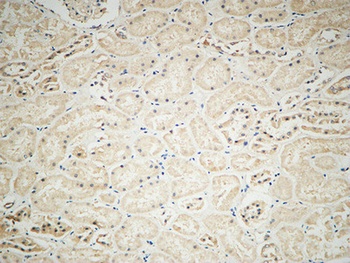 Integrin αV rabbit pAb