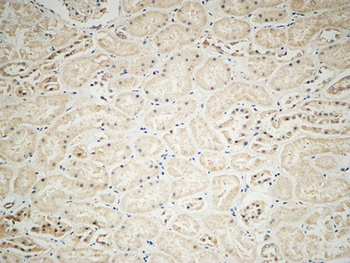 Integrin alphaV antibody