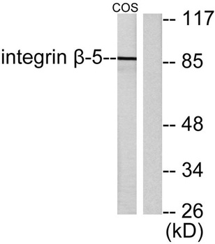 Integrin β5 rabbit pAb Antibody