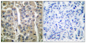 Involucrin rabbit pAb