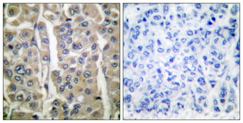 Involucrin antibody