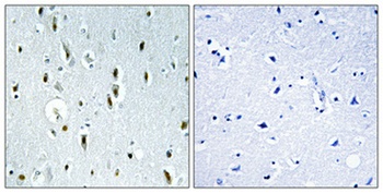 IP6K2 antibody