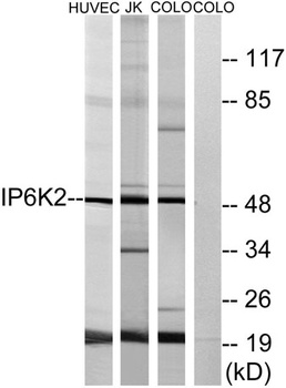 IP6K2 antibody