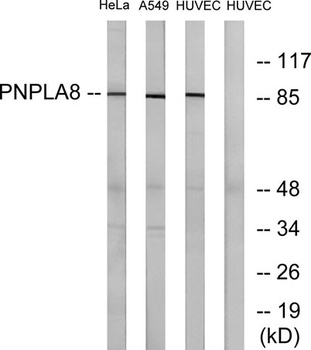 iPLA2γ rabbit pAb