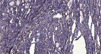 iPLA2γ rabbit pAb