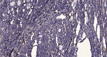 iPLA2 gamma antibody