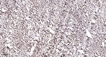 IPMK antibody