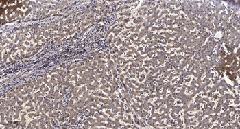 IRAK-2 antibody