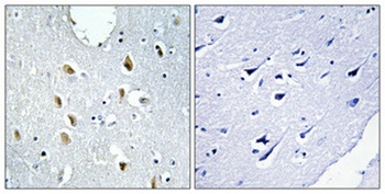 IRF-4 antibody