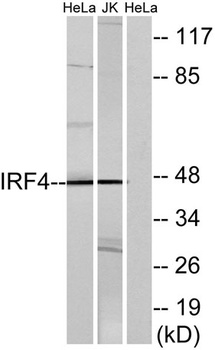 IRF-4 rabbit pAb