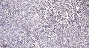 IRTKS antibody