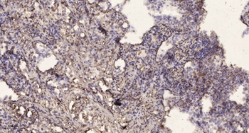 Islet-2 antibody