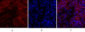 JAK1 antibody