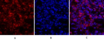 JAK1 antibody