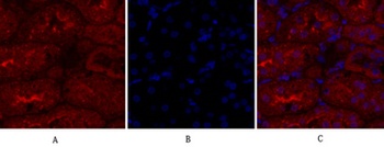 JAK1 antibody