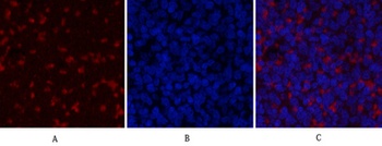 JAK2 antibody