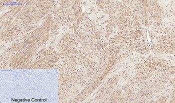 JAK2 antibody