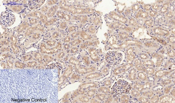 JAK2 antibody