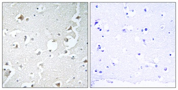 JIP-1 antibody