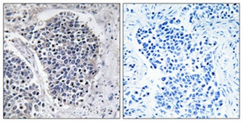 JIP-3 antibody