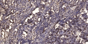 KALIG-1 rabbit pAb