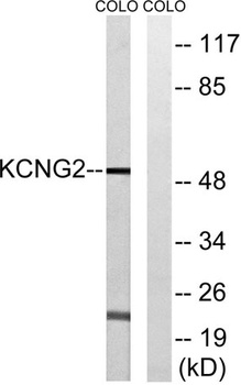 KCNG2 rabbit pAb