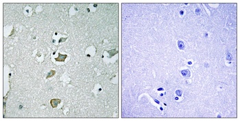 KIR2.1 antibody