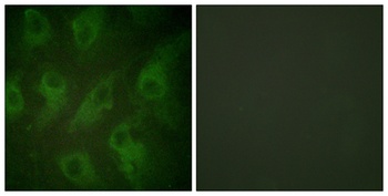 KIR6.2 antibody