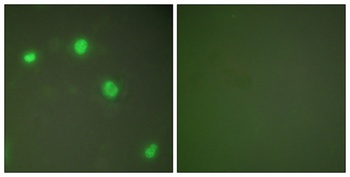 Ku-70 antibody