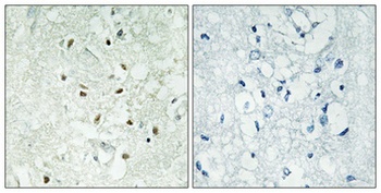 Ku-86 rabbit pAb Antibody