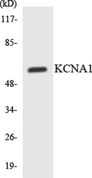 KV1.1 antibody
