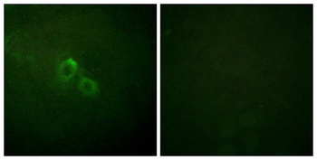 Kv1.3 antibody