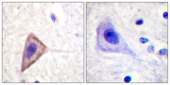 Kv1.3 rabbit pAb