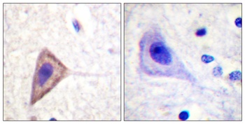 Kv1.3 antibody