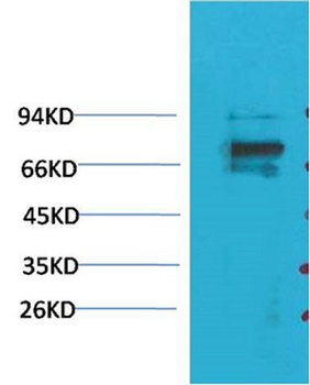 KV1.5 antibody