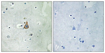 KV3.1 rabbit pAb