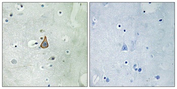 KV3.1 antibody