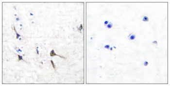 KV3.2 rabbit pAb