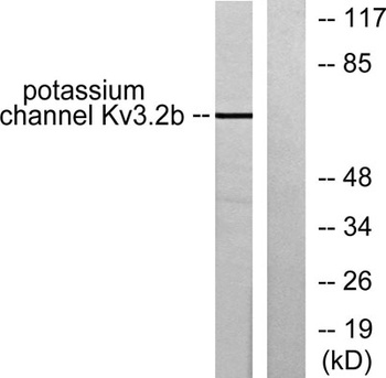 KV3.2 rabbit pAb