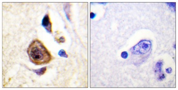Kv3.4 rabbit pAb