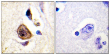 Kv3.4 antibody