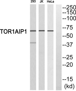 LAP1B antibody