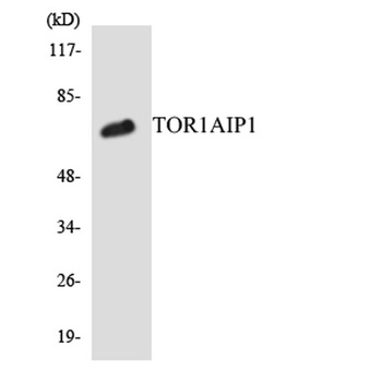 LAP1B antibody