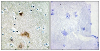 LASS4 antibody